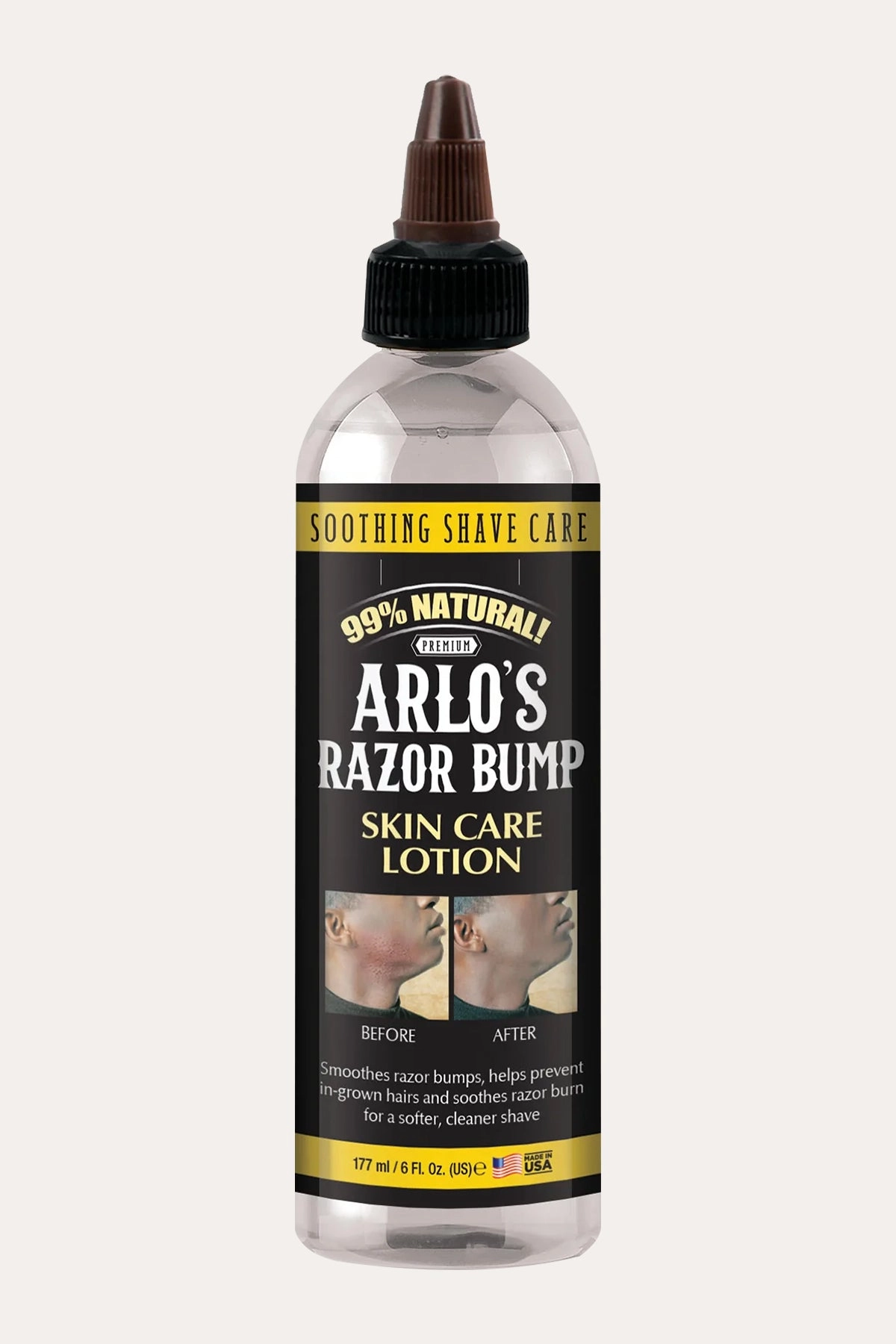 ARLO'S RAZOR BUMP SKIN CARE LOTION 6oz